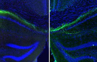 El cerebro empieza a organizar cómo veremos el mundo antes de que abramos los ojos