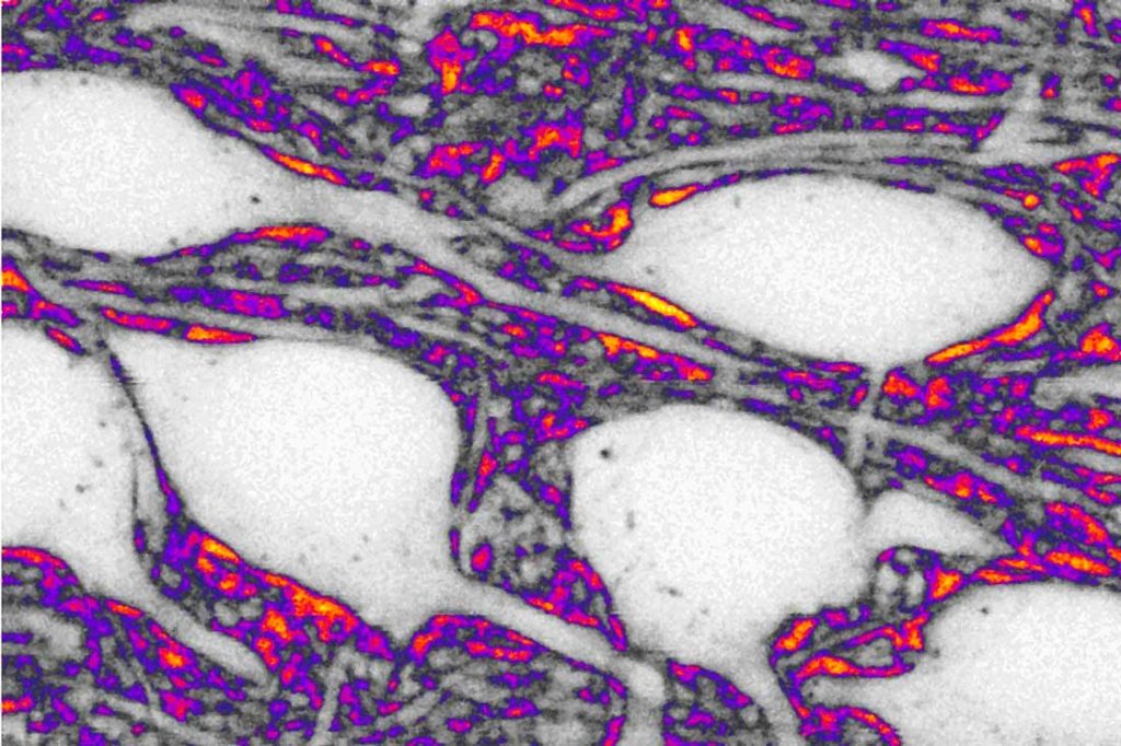 Neuronas en blanco y espacio extracelular en color. /Jan Tonnesen