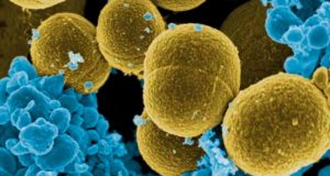 Una bacteria presente en el 30% de la población esconde una clave que puede cambiar el tratamiento de infecciones mortales