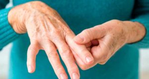 Un fármaco logra reducir a la mitad el riesgo de desarrollar artritis reumatoide