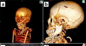 Dos momias infantiles cambian lo que se sabía sobre la momificación en el Antiguo Egipto