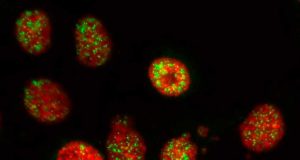 Localizan una proteína responsable de la resistencia del cáncer de páncreas para atacar al tumor desde ‘dentro y fuera’