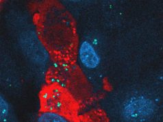 Nueva estrategia para combatir una de las bacterias más difíciles de eliminar