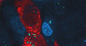 Nueva estrategia para combatir una de las bacterias más difíciles de eliminar