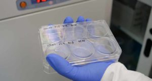 Una tecnología que abre la puerta al diagnóstico precoz y la medicina personalizada
