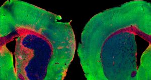 Descubren que una molécula vinculada al sueño podría abrir una nueva vía para tratar el ictus
