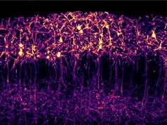 Descubren cómo una proteína organiza la comunicación los dos hemisferios del cerebro