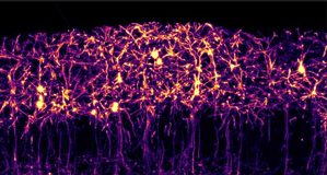 Descubren cómo una proteína organiza la comunicación los dos hemisferios del cerebro