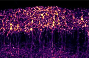 Descubren cómo una proteína organiza la comunicación los dos hemisferios del cerebro