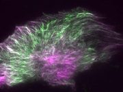 Descubren que el paclitaxel, uno de los fármacos contra el cáncer más usados, hace que las células tumorales se contraigan