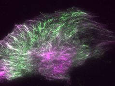 Descubren que el paclitaxel, uno de los fármacos contra el cáncer más usados, hace que las células tumorales se contraigan