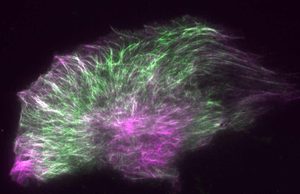 Descubren que el paclitaxel, uno de los fármacos contra el cáncer más usados, hace que las células tumorales se contraigan