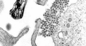 El dengue debilita temporalmente la barrera de los vasos sanguíneos
