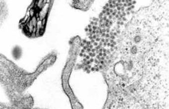 El dengue debilita temporalmente la barrera de los vasos sanguíneos