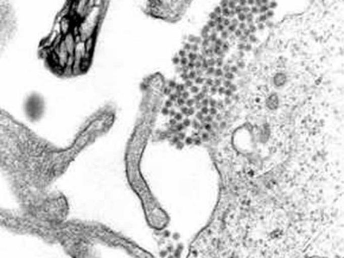 El dengue debilita temporalmente la barrera de los vasos sanguíneos