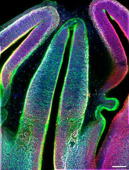 What Is Neuron Definiton Un atlas del tálamo embrionario revela cómo se forman las neuronas y ...