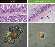 Descubren el mecanismo molecular que sostiene la barrera intestinal frente infecciones graves