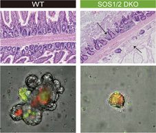 Descubren el mecanismo molecular que sostiene la barrera intestinal frente infecciones graves