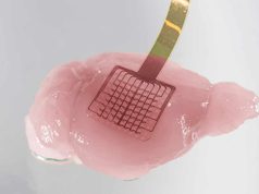 Una nueva tecnología de grafeno monitoriza el cerebro tras un ictus y detecta tejido en riesgo